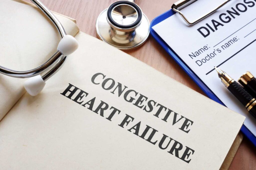 Congestive Heart Failure with diagnosis form, related to life expectancy with CHF
