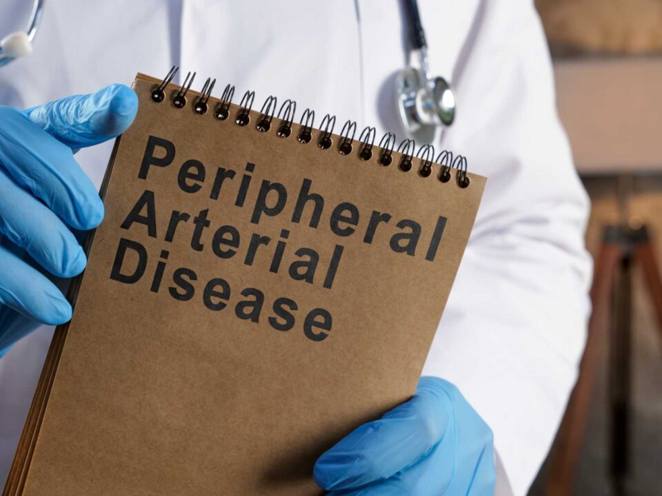 A doctor treating peripheral artery disease in Sugar Land, TX